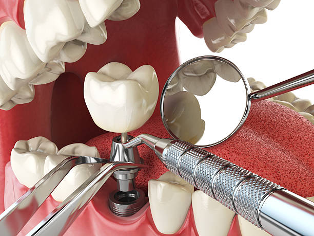 Best Weekend Emergency Dentist in Soap Lake, WA